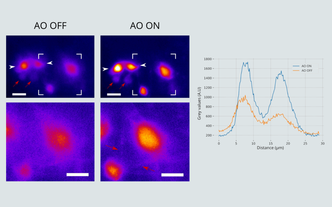 Boosting Neuroimaging: The Synergy of Adaptive Optics and Light-Sheet Fluorescence Microscopy
