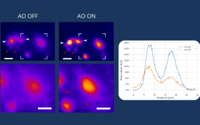 Boosting Neuroimaging: The Synergy of Adaptive Optics and Light-Sheet Fluorescence Microscopy