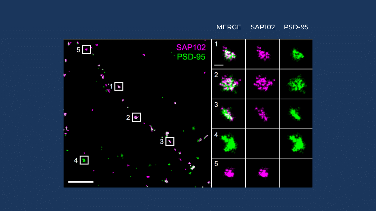 Example of Mirao 52e implementation on a super-resolution microscope