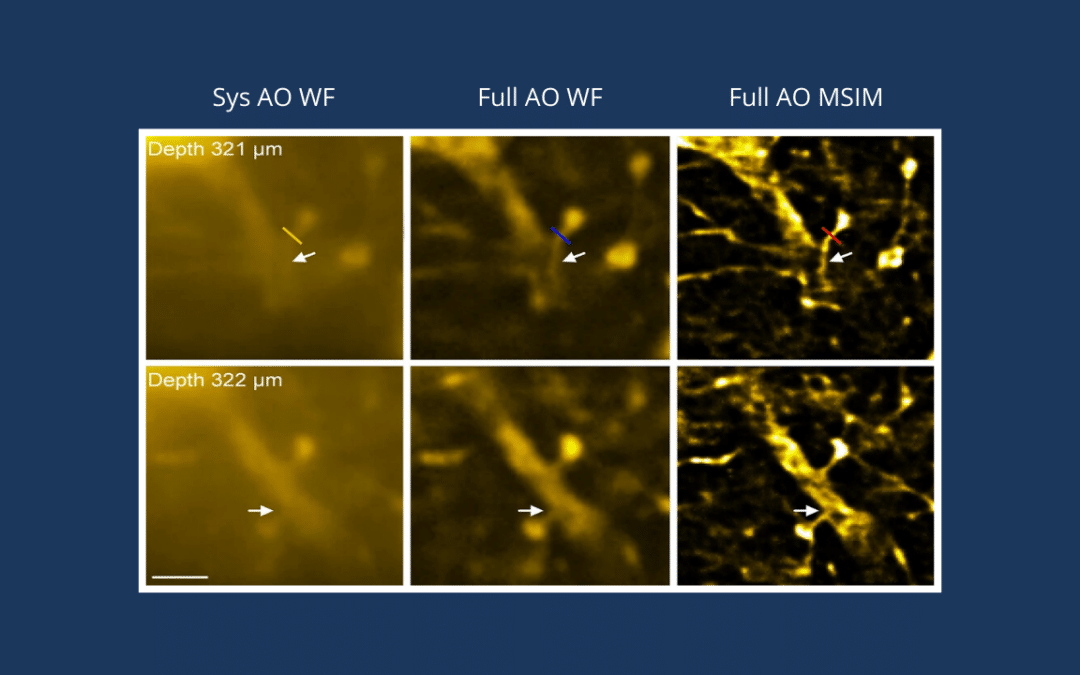 Adaptive Optics enables deep imaging in 2-photon super-resolution structured illumination microscopy